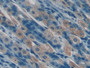 DAB staining on fromalin fixed paraffin-embedded Kidney tissue)