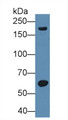 Western Blot; Sample: Rat Serum; ; Primary Ab: 3µg/ml Rabbit Anti-Rat MMP12 Antibody; Second Ab: 0.2µg/mL HRP-Linked Caprine Anti-Rabbit IgG Polyclonal Antibody;