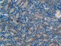 DAB staining on IHC-P; Samples: Mouse Kidney Tissue; Primary Ab: 10µg/ml Rabbit Anti-Mouse MMP12 Antibody Second Ab: 2µg/mL HRP-Linked Caprine Anti-Rabbit IgG Polyclonal Antibody