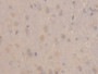 DAB staining on IHC-P; Samples: Rat Cerebrum Tissue;  Primary Ab: 20µg/ml Rabbit Anti-Rat RBP1 Antib