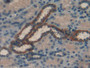DAB staining on IHC-P; Samples: Human Kidney Tissue;  Primary Ab: 10µg/ml Rabbit Anti-Human RBP1 Ant