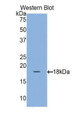 Western Blot; Sample: Recombinant protein.