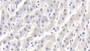 DAB staining on IHC-P; Samples: Bovine Liver Tissue;  Primary Ab: 20μg/ml Rabbit Anti-Bovine RBP1 Antibody Second Ab: 2µg/mL HRP-Linked Caprine Anti-Rabbit IgG Polyclonal Antibody 