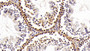 DAB staining on IHC-P; Samples: Mouse Testis Tissue; Primary Ab: 10μg/ml Rabbit Anti-Mouse HMG1 Antibody Second Ab: 2µg/mL HRP-Linked Caprine Anti-Rabbit IgG Polyclonal Antibody