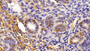 DAB staining on fromalin fixed paraffin-embedded Kidney tissue)