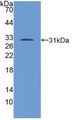 Western Blot; Sample: Recombinant TGFbR1, Human.