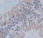 Inhibin Alpha (Inha) Polyclonal Antibody, Cat#CAU27980