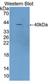 Figure. Western Blot; Sample: Recombinant C4a, Mouse.