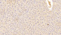DAB staining on IHC-P; Samples: Mouse Liver Tissue; Primary Ab: 20μg/ml Rabbit Anti-Mouse C3a Antibody Second Ab: 2µg/mL HRP-Linked Caprine Anti-Rabbit IgG Polyclonal Antibody