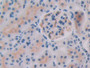 DAB staining on IHC-P; Samples: Rat Kidney Tissue; Primary Ab: 30µg/ml Rabbit Anti-Rat IL27 Antibody Second Ab: 2µg/mL HRP-Linked Caprine Anti-Rabbit IgG Polyclonal Antibody
