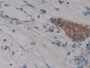 DAB staining on fromalin fixed paraffin- embedded stomach tissue)