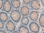 DAB staining on IHC-P; Samples: Human Rectum Tissue;  Primary Ab: 20µg/ml Rabbit Anti-Human RBP2 Ant