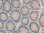 DAB staining on IHC-P; Samples: Human Rectum Tissue