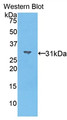 Western Blot; Sample: Recombinant MYO1A, Mouse.