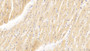 DAB staining on IHC-P; Samples: Human Cardiac Muscle Tissue;  Primary Ab: 20μg/ml Rabbit Anti-Human GATA4 Antibody Second Ab: 2µg/mL HRP-Linked Caprine Anti-Rabbit IgG Polyclonal Antibody 