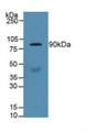 Western Blot; Sample: Human Serum.