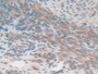 DAB staining on IHC-P; Samples: Mouse Uterus Tissue.