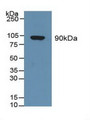 Western Blot; Sample: Human Serum.