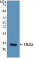 Western Blot; Sample: Recombinant IP10, Human.