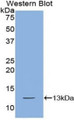 Western Blot; Sample: Recombinant protein.