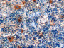 DAB staining on IHC-P; Samples: Rat Spleen Tissue;  Primary Ab: 10µg/ml Rabbit Anti-Rat bTG Antibody