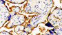 DAB staining on IHC-P; Samples: Human Placenta Tissue;  Primary Ab: 10μg/ml Rabbit Anti-Porcine bTG Antibody Second Ab: 2µg/mL HRP-Linked Caprine Anti-Rabbit IgG Polyclonal Antibody 