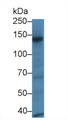 Western Blot; Sample: Mouse Eye lysate; ;Primary Ab: 1µg/ml Rabbit Anti-Rat RBP3 Antibody;Second Ab: 0.2µg/mL HRP-Linked Caprine Anti-Rabbit IgG Polyclonal Antibody;