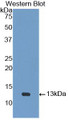 Western Blot; Sample: Recombinant protein.