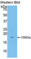 Western Blot; Sample: Recombinant ACP, Human.