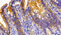 DAB staining on IHC-P; Samples: Porcine Small intestine Tissue;  Primary Ab: 10μg/ml Rabbit Anti-Porcine FABP6 Antibody Second Ab: 2µg/mL HRP-Linked Caprine Anti-Rabbit IgG Polyclonal Antibody 