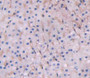 Used in DAB staining on fromalin fixed paraffin- embedded adrenal gland tissue