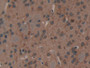 DAB staining on IHC-P; Samples: Mouse Brain Tissue; Primary Ab: 20µg/ml Rabbit Anti-Mouse MAP1A Antibody Second Ab: 2µg/mL HRP-Linked Caprine Anti-Rabbit IgG Polyclonal Antibody