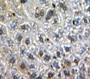 Used in DAB staining on fromalin fixed paraffin-embedded Liver tissue