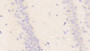 DAB staining on IHC-P; Samples: Mouse Cerebellum Tissue; Primary Ab: 20μg/ml Rabbit Anti-Mouse NOS1AP Antibody Second Ab: 2µg/mL HRP-Linked Caprine Anti-Rabbit IgG Polyclonal Antibody