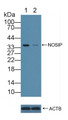 Knockout Varification: ; Lane 1: Wild-type 293T cell lysate; ; Lane 2: NOSIP knockout 293T cell lysate; ; Predicted MW: 33kd ; Observed MW: 35kd; Primary Ab: 5µg/ml Rabbit Anti-Human NOSIP Antibody; Second Ab: 0.2µg/mL HRP-Linked Caprine Anti-Rabbit IgG Polyclonal Antibody;