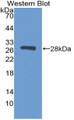 Western Blot; Sample: Recombinant protein.