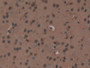 DAB staining on IHC-P; Samples: Mouse Heart Tissue; Primary Ab: 20µg/ml Rabbit Anti-Mouse XRCC6 Antibody Second Ab: 2µg/mL HRP-Linked Caprine Anti-Rabbit IgG Polyclonal Antibody