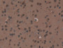 DAB staining on IHC-P; Samples: Mouse Heart Tissue)