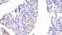 DAB staining on fromalin fixed paraffin-embedded Liver tissue)