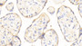 DAB staining on IHC-P; Samples: Human Placenta Tissue; Primary Ab: 20μg/ml Rabbit Anti-Human APOH Antibody Second Ab: 2µg/mL HRP-Linked Caprine Anti-Rabbit IgG Polyclonal Antibody