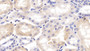 DAB staining on IHC-P; Samples: Bovine Kidney Tissue;  Primary Ab: 20µg/ml Rabbit Anti-Bovine APOH Antibody Second Ab: 2µg/mL HRP-Linked Caprine Anti-Rabbit IgG Polyclonal Antibody 