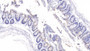 DAB staining on IHC-P; Samples: Rat Colon Tissue;  Primary Ab: 20µg/ml Rabbit Anti-Rat GAL9 Antibody Second Ab: 2µg/mL HRP-Linked Caprine Anti-Rabbit IgG Polyclonal Antibody 