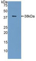 Western Blot; Sample: Recombinant GAL8, Human.