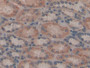 DAB staining on IHC-P; Samples: Human Kidney Tissue; Primary Ab: 20µg/ml Rabbit Anti-Human GAL8 Antibody Second Ab: 2µg/mL HRP-Linked Caprine Anti-Rabbit IgG Polyclonal Antibody