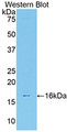 Western Blot; Sample: Recombinant protein.