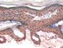 DAB staining on IHC-P; Samples: Rat Skin Tissue; Primary Ab: 20µg/ml Rabbit Anti-Rat GAL7 Antibody Second Ab: 2µg/mL HRP-Linked Caprine Anti-Rabbit IgG Polyclonal Antibody