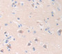 Galectin 7 (Gal7) Polyclonal Antibody, Cat#CAU28136