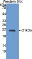 Western Blot; Sample: Recombinant protein.