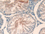 DAB staining on IHC-P; Samples: Rat Testis Tissue; Primary Ab: 20µg/ml Rabbit Anti-Rat TBG Antibody Second Ab: 2µg/mL HRP-Linked Caprine Anti-Rabbit IgG Polyclonal Antibody