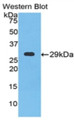 Western Blot; Sample: Recombinant protein.